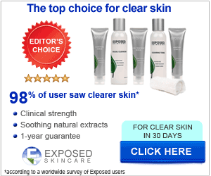 Exposed Skin Care UK 