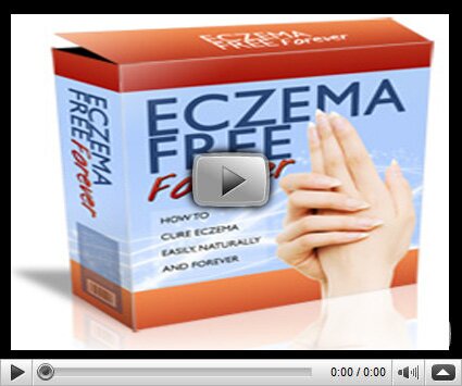 Eczema Free Forever PDF