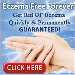 Eczema Free Forever Pros 