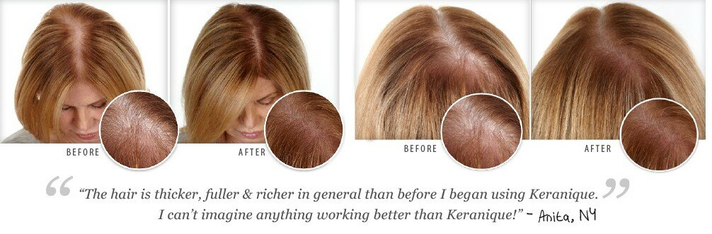 keranique-hair-regrowth-treatment-benefits