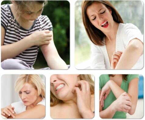 Eczema Free Forever Review 